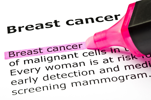 Breast Cancer myths