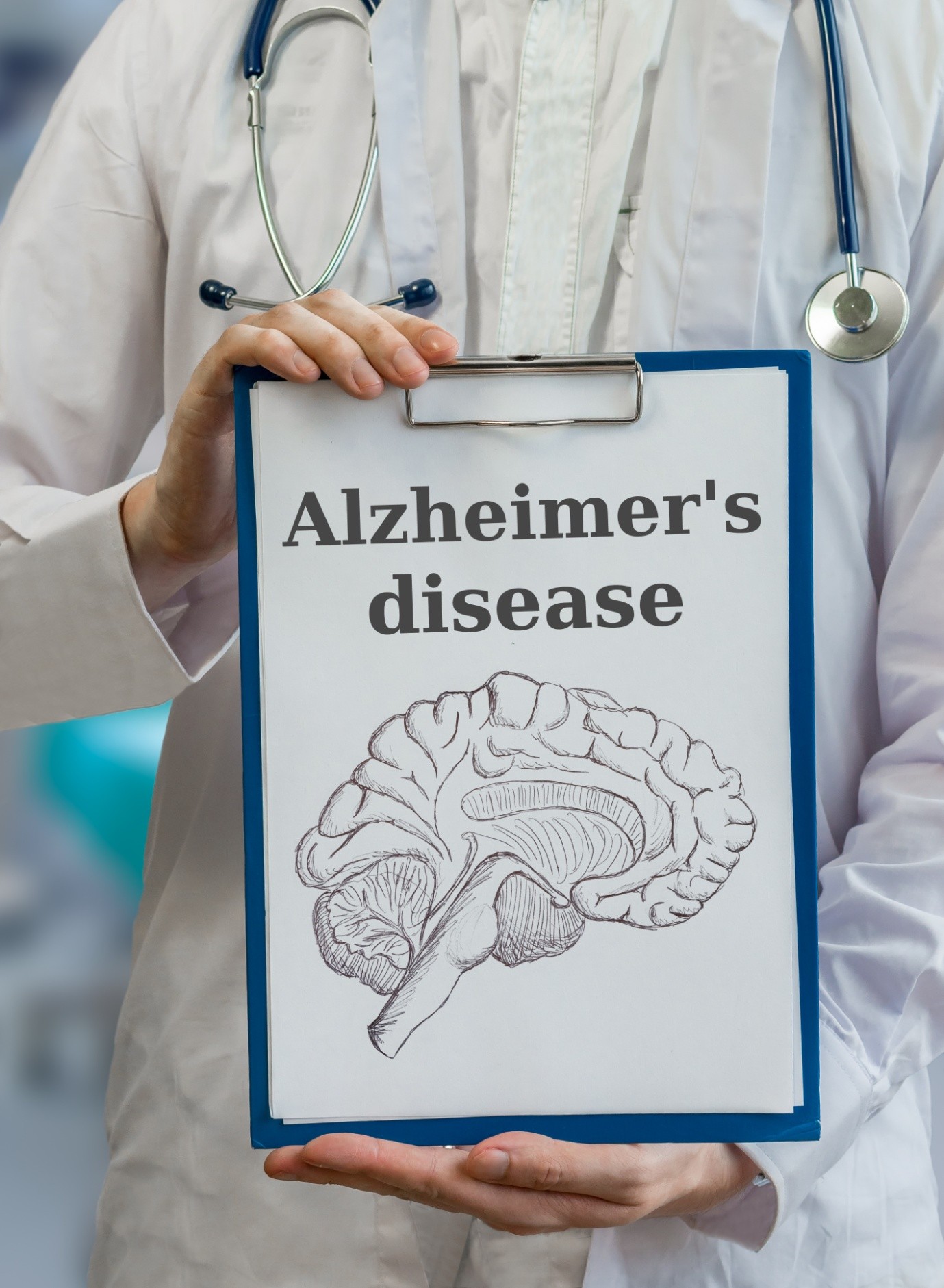 Can Diet Prevent Alzheimer’s disease?