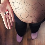 HCG vaccines for Infertility in Women