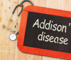 Addison’s disease