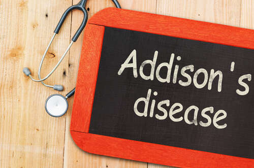 Addison’s disease