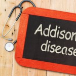 Addison’s disease