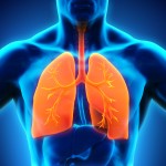 Bronchitis