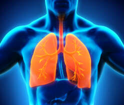 Bronchitis
