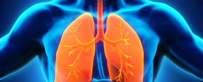 Bronchitis
