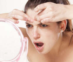 Risk Factors of Acne