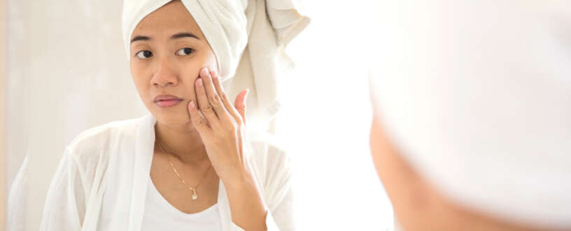 Acne removal methods