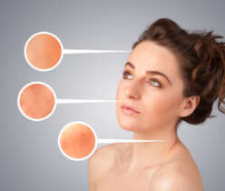Culprits in Skin Damage