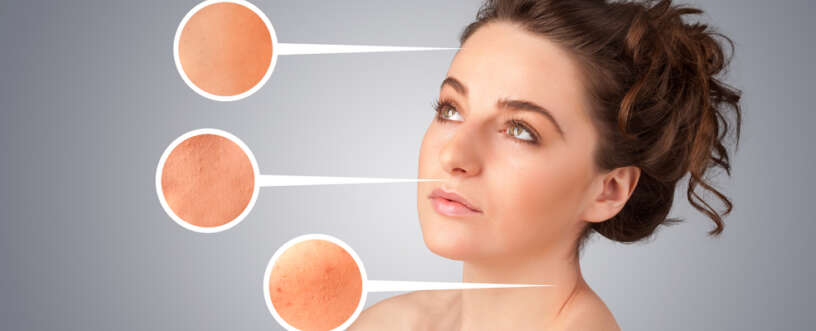Culprits in Skin Damage