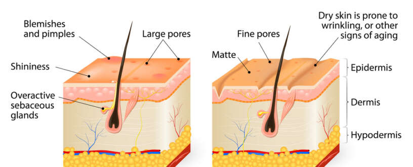 Oily Skin Do’s and Don'ts
