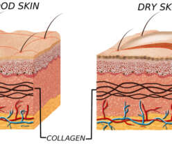 Skincare for dry skin