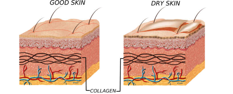 Skincare for dry skin