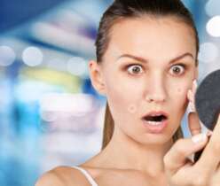Large Pores and Acne