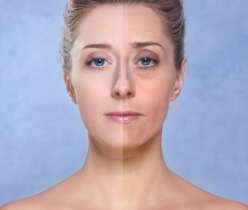 Anti-aging tips: A good option to retain youth for long