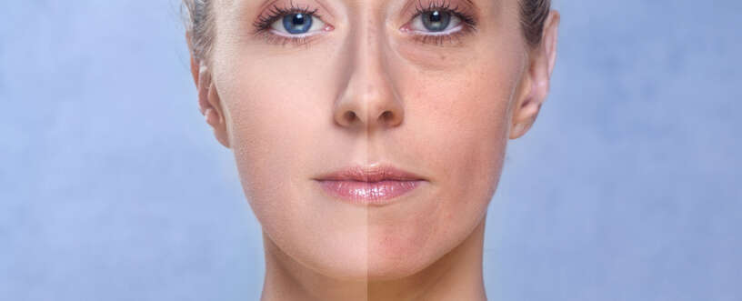 Anti-aging tips: A good option to retain youth for long