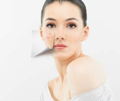 Deal with adult acne with utmost care
