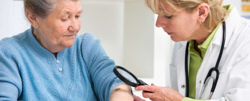 Skin cancer prevention is as crucial as treatment