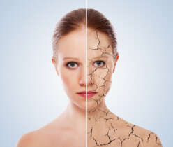 Dry skin treatment is easy and affordable