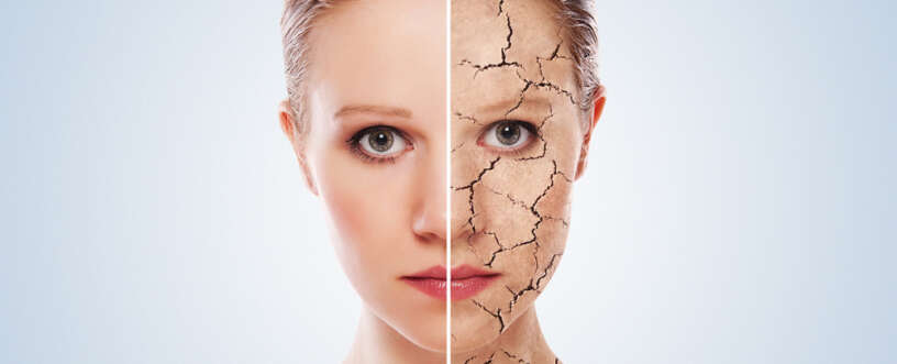 Dry skin treatment is easy and affordable