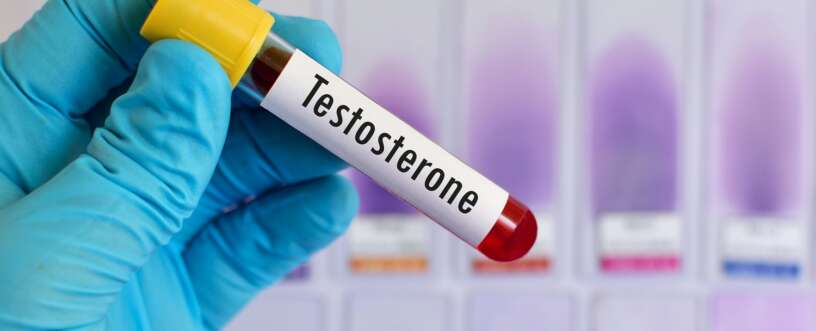 The myth of too much testosterone