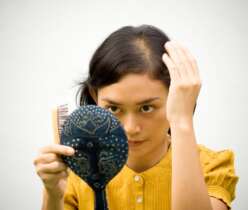 What is female pattern baldness?
