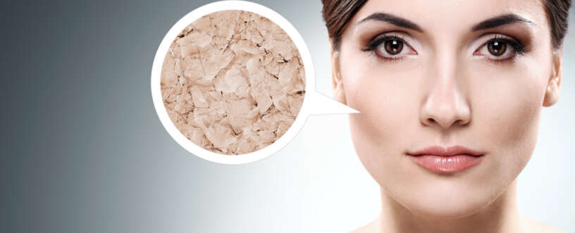 The Dry Skin Diet