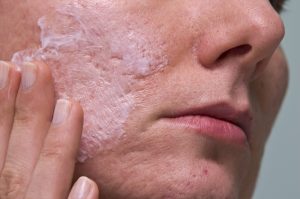 Clear Acne Scars Fast & Simple with the Best Methods