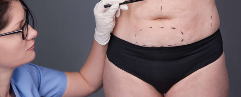 Bad effects of weight loss surgery