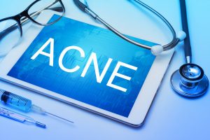 Tips and Treatments to Help Clear Your Severe Skin Acne