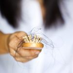 Causes of Hair Loss in Teenage Girls
