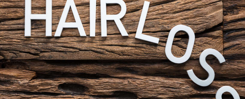 What Can You Do To Prevent Hair Loss?