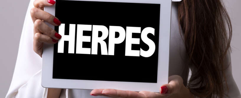 Why Allow Herpes Ruin Your Sex Life?