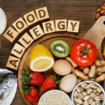 food allergies