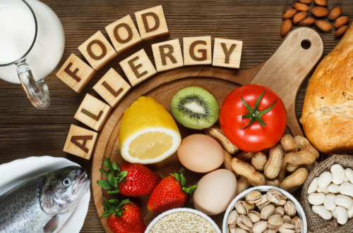 food allergies