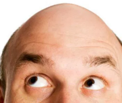 hair loss and diabetes