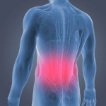 back pain