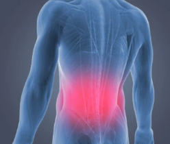 back pain