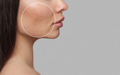 How to Get Rid of Pigmentation - INLIFE Healthcare