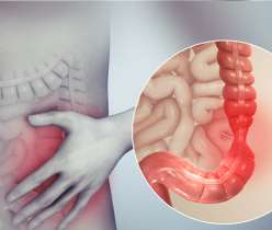 irritable bowel syndrome ibs symptoms causes treatment