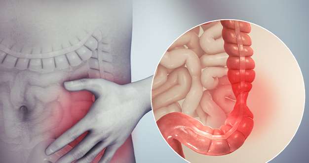 irritable bowel syndrome ibs symptoms causes treatment