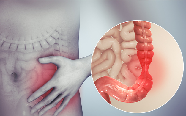 irritable bowel syndrome ibs symptoms causes treatment