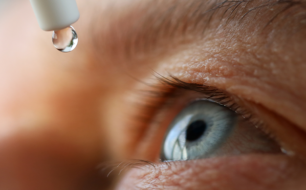 dry eyes causes symptoms and treatment