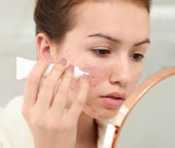 Different Kinds Of Acne & How To Treat Them