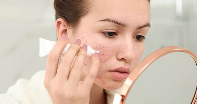 Different Kinds Of Acne & How To Treat Them