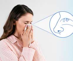 Nasal Polyps Causes