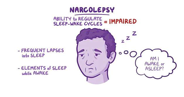 Narcolepsy