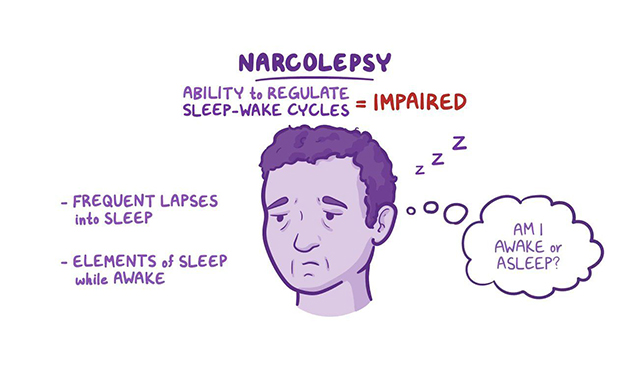 Narcolepsy