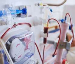 Peritoneal Dialysis