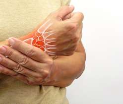 Early symptoms of rheumatoid arthritis, showing joint inflammation and pain in the wrist, highlighting potential signs for timely diagnosis and treatment.
