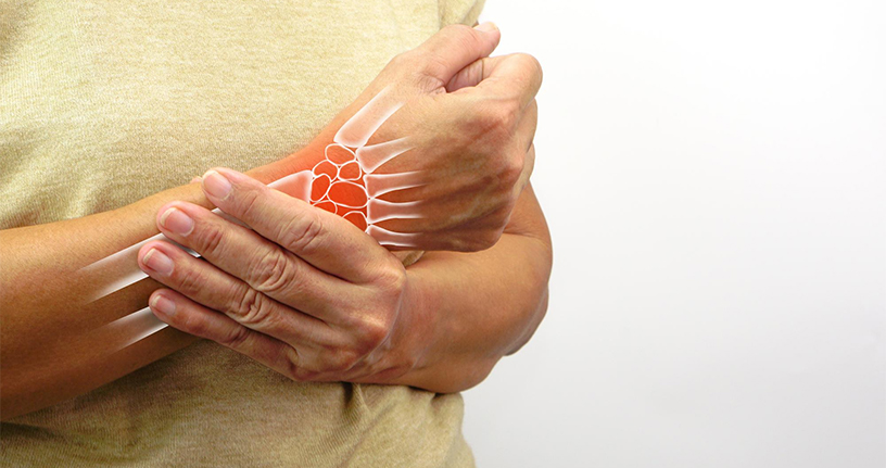 Early symptoms of rheumatoid arthritis, showing joint inflammation and pain in the wrist, highlighting potential signs for timely diagnosis and treatment.